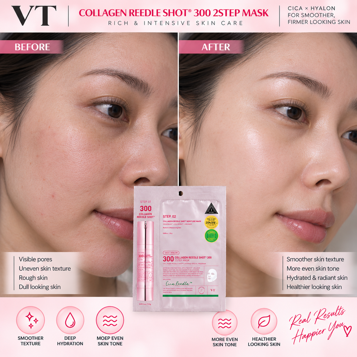 VT Collagen Reedle Shot 300 2step Mask (1.5g+25g)