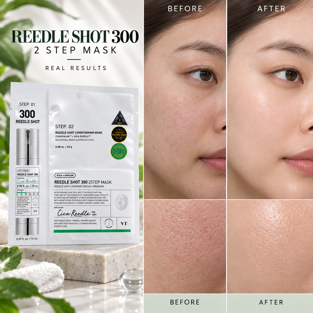 VT Reedle Shot 300 2-step Mask (1.5g+25g)