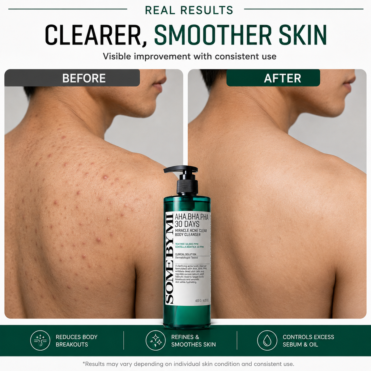 SOME BY MI AHA BHA PHA 30days Miracle Acne Clear Body Cleanser 400g