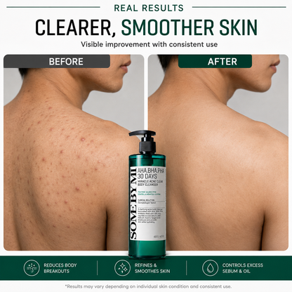 SOME BY MI AHA BHA PHA 30days Miracle Acne Clear Body Cleanser 400g