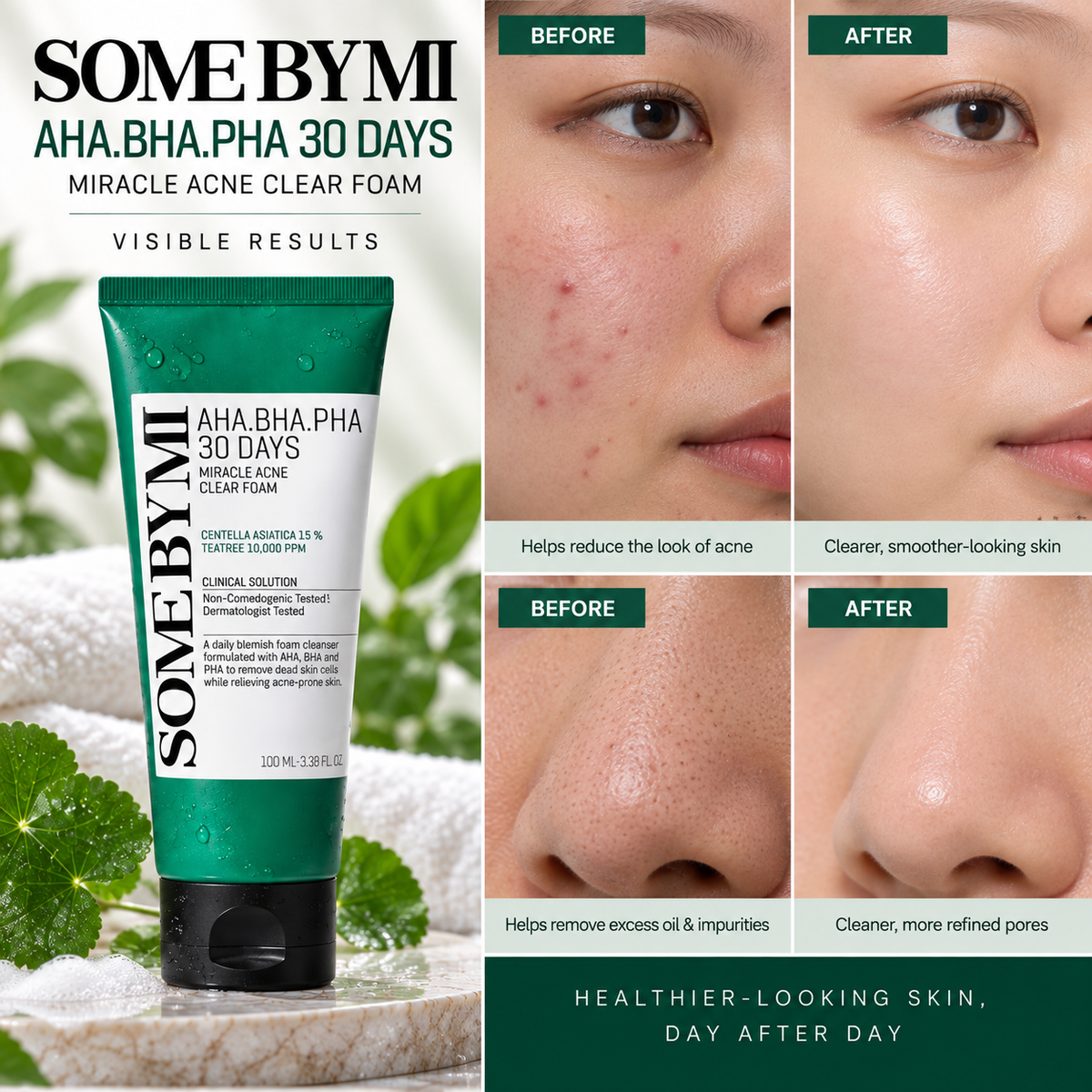 SOME BY MI AHA BHA PHA 30days Miracle Acne Clear Foam 100ml