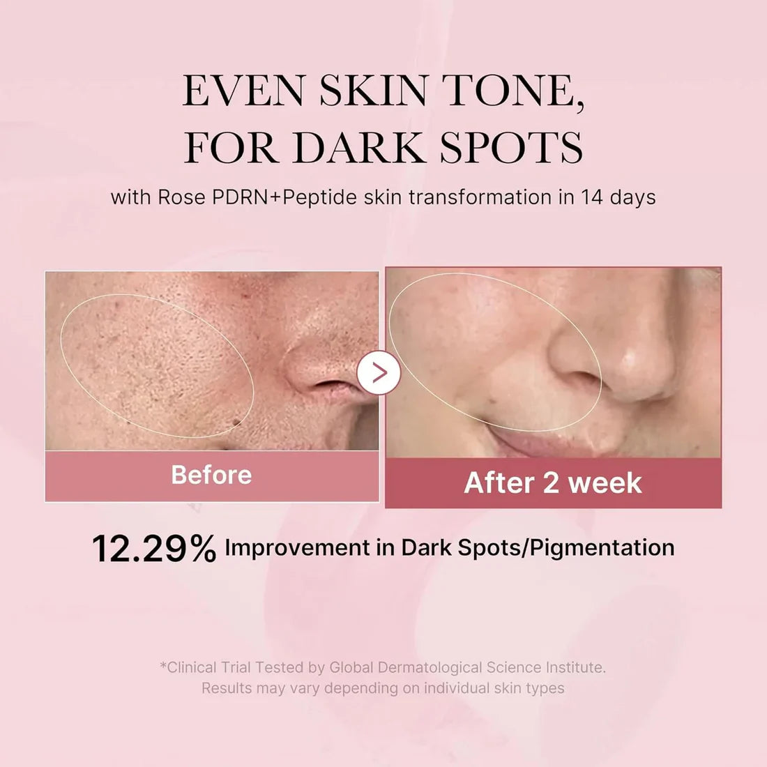 [MEDICUBE] PDRN PINK NIACINAMAIDE MILKY TONER 150ML