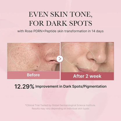 [MEDICUBE] PDRN PINK NIACINAMAIDE MILKY TONER 150ML