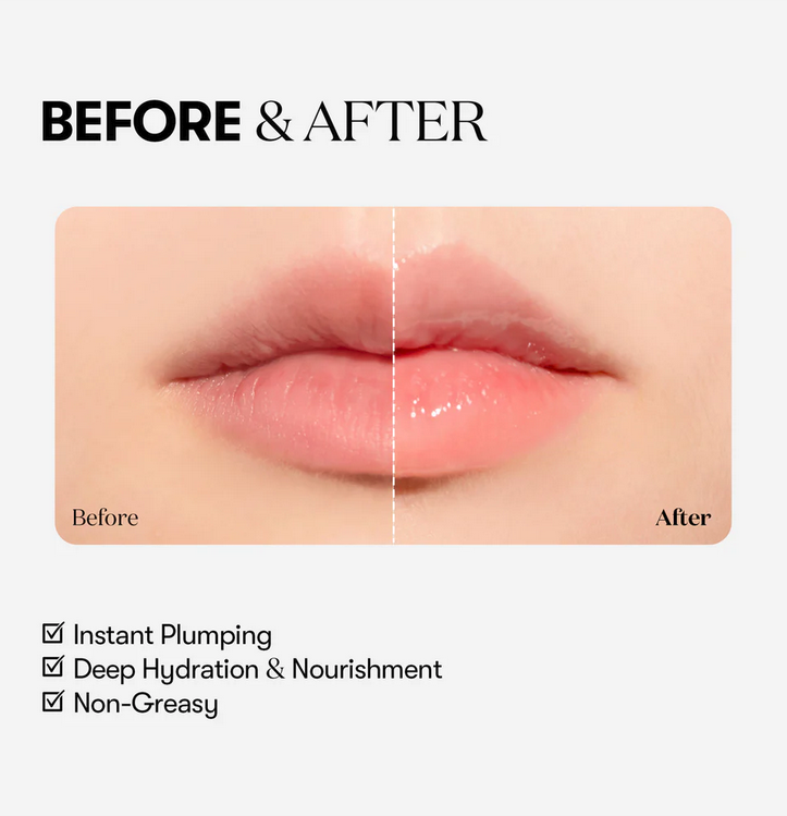 REEDLE SHOT LIP PLUMPER BEGINNER 4.3G