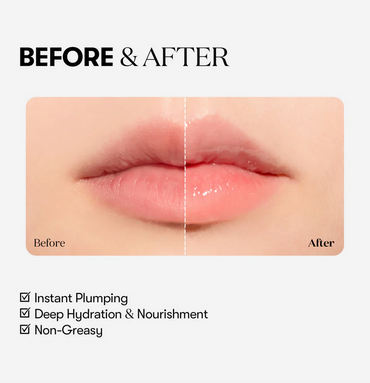 REEDLE SHOT LIP PLUMPER BEGINNER 4.3G