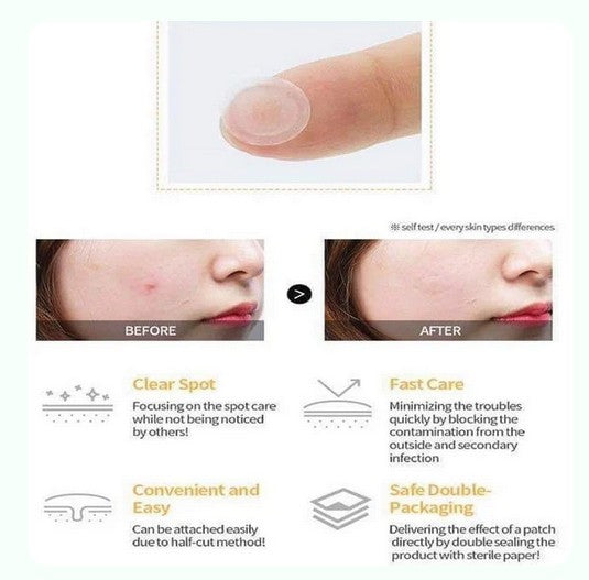 Fresh Herb Origin Clear Spot Patch (29PCS)