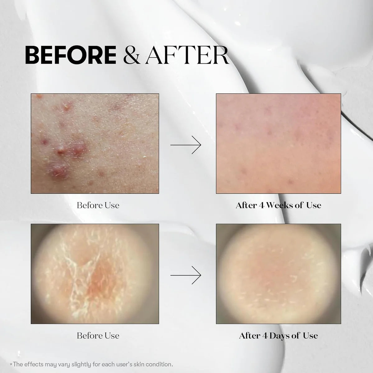 COLLAGEN REEDLE SHOT 300 50ML
