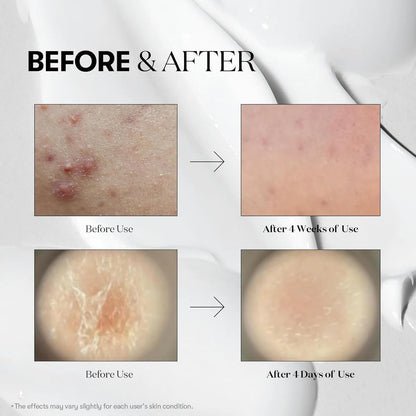 COLLAGEN REEDLE SHOT 300 50ML